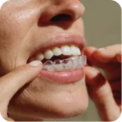 Person applying a clear aligner